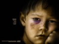 /album/photo-gallery-fotos/maltrato-infantil-381910-t0-1-jpg/